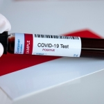 Landak Pesan 1.000 Rapid Test