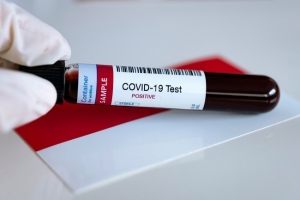 Landak Pesan 1.000 Rapid Test