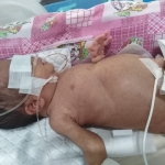 Tolong! Balita Berusia 14 Hari Ini Butuh Biaya Operasi