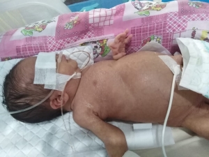 Kabar Duka, Muhammad Hanif Al-Fathan Meninggal Dunia di Tengah Upaya Menggalang Dana untuk Biaya Operasi